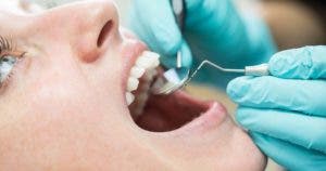 Abcès dentaire Comment le traiter rapidement et le prévenir 